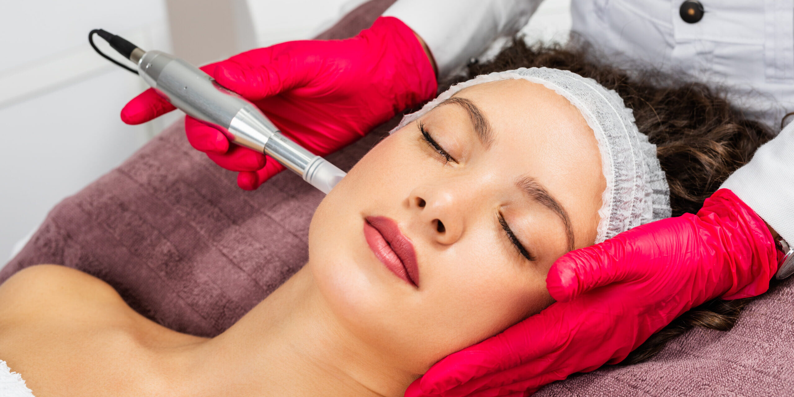 7 Reasons Microneedling is Sweeter than Christmas Morning