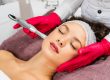 microneedling treatment