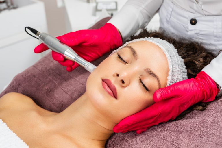 microneedling treatment