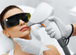 Laser Hair Removal