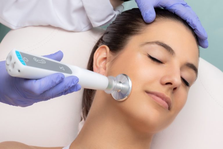 How many laser treatments are needed for facial veins